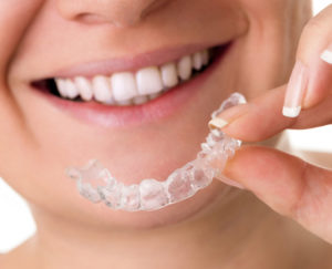 Invisalign usynlig tannregulering
