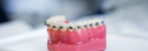 finansiering og økonomisk støtte til tannbehandling
