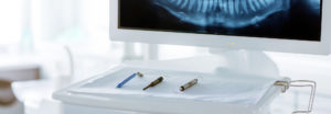 tannlegeutstyr røntgenbilde