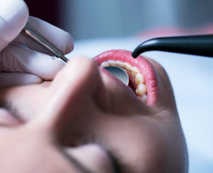 Tannstilling kjevekirurgi undersøkelse