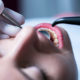 Tannstilling kjevekirurgi undersøkelse